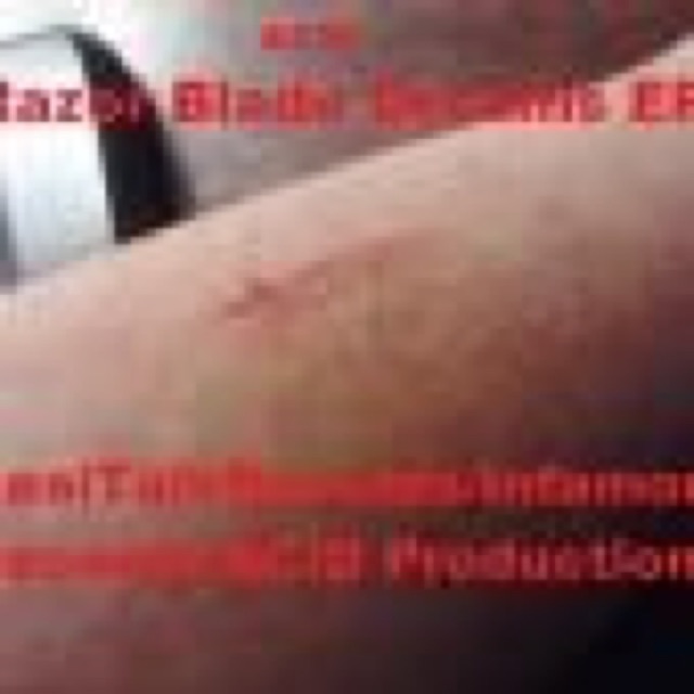 Razor Blade Dreams EP cover